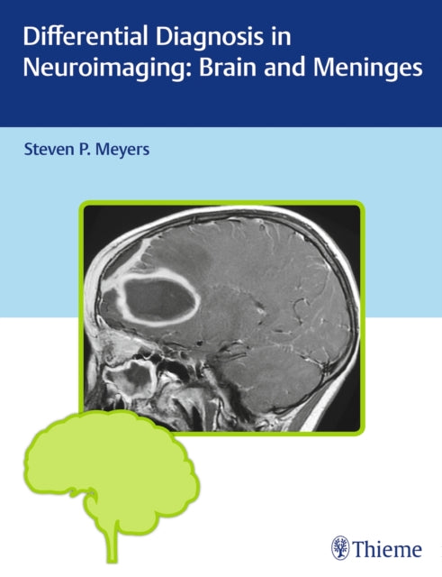 Book cover of: Differential Diagnosis in Neuroimaging: Brain and Meninges. By: Steven P. Meyers