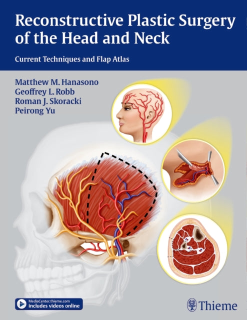 Book cover of: Reconstructive Plastic Surgery of the Head and Neck. By: Matthew M. Hanasono