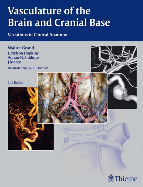 Book cover of: Vasculature of the Brain and Cranial Base. By: Walter Grand