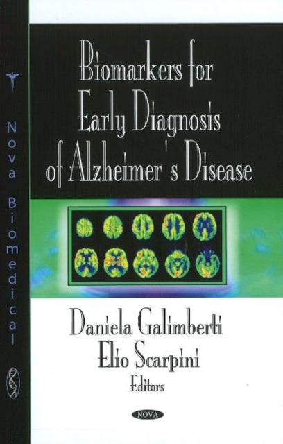 Book cover of: Biomarkers for Early Diagnosis of Alzheimer's Disease