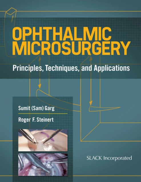 Book cover of: Ophthalmic Microsurgery. By: Sumit Garg MD