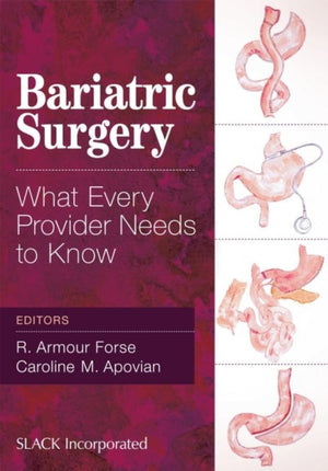 Bariatric Surgery