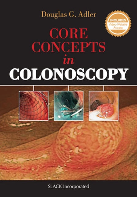 Book cover of: Core Concepts in Colonoscopy. By: Douglas Adler MD