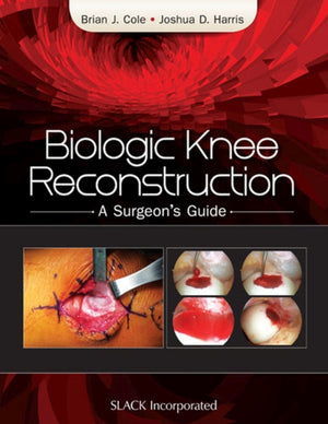 Biologic Knee Reconstruction