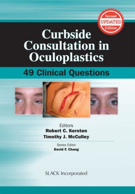 Book cover of: Curbside Consultation in Oculoplastics. By: Robert C. Kersten