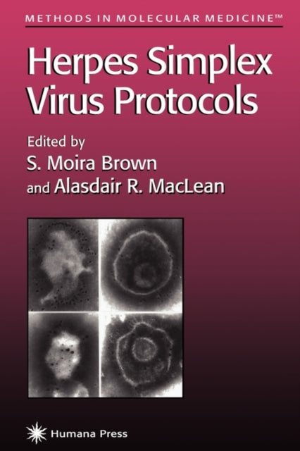 Book cover of: Herpes Simplex Virus Protocols. By: S. Moira Brown