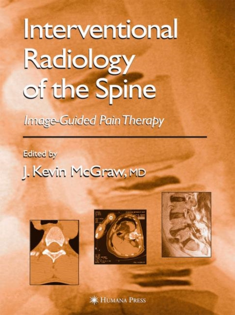 Book cover of: Interventional Radiology of the Spine