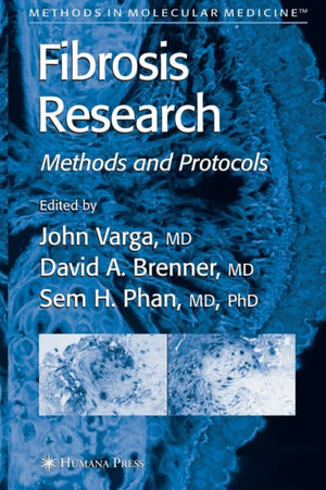 Fibrosis Research