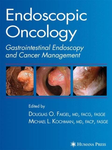 Book cover of: Endoscopic Oncology. By: Douglas O. Faigel