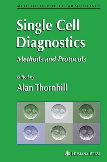 Single Cell Diagnostics