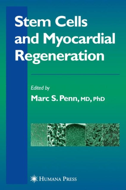Book cover of: Stem Cells and Myocardial Regeneration. By: Marc S. Penn