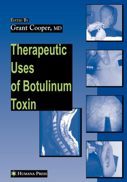 Book cover of: Therapeutic Uses of Botulinum Toxin. By: Grant Cooper