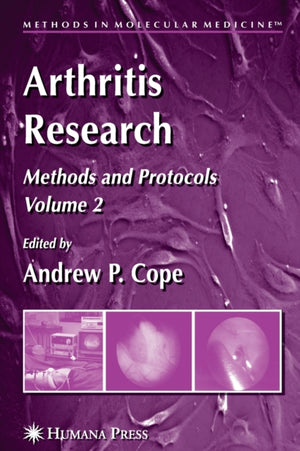 Arthritis Research