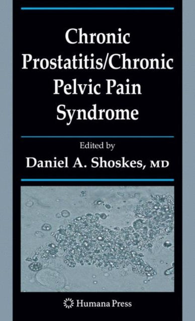 Book cover of: Chronic Prostatitis/Chronic Pelvic Pain Syndrome. By: Daniel A. Shoskes