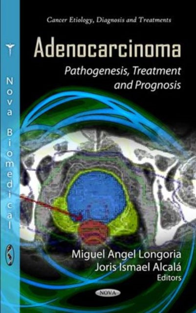 Book cover of: Adenocarcinoma. By: Miguel Angel Longoria