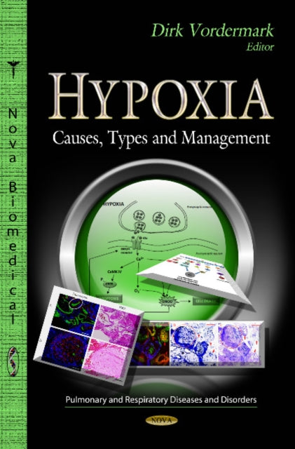 Book cover of: Hypoxia. By: Dirk Vordermark