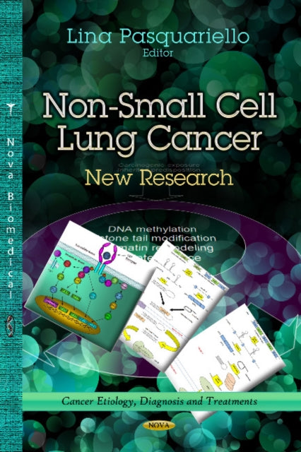 Book cover of: Non-Small Cell Lung Cancer