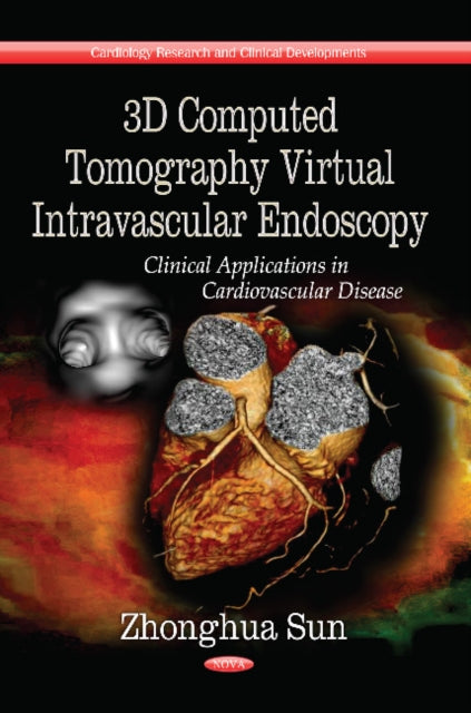 Book cover of: 3D Computed Tomography Virtual Intravascular Endoscopy