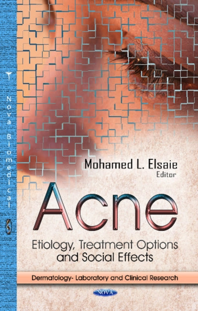 Book cover of: Acne