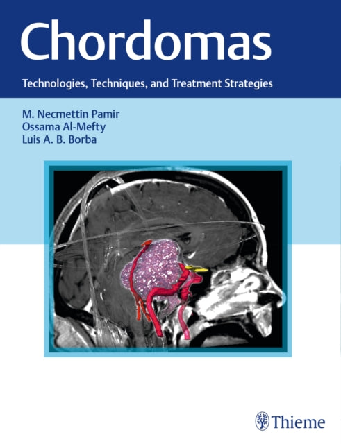 Book cover of: Chordomas. By: M. Necmettin Pamir