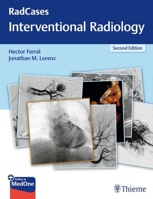 Book cover of: RadCases Q&a Interventional Radiology. By: Hector Ferral