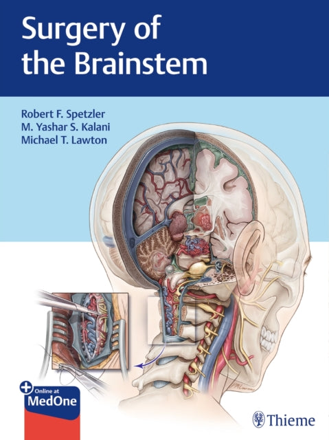Book cover of: Surgery of the Brainstem. By: Robert F. Spetzler