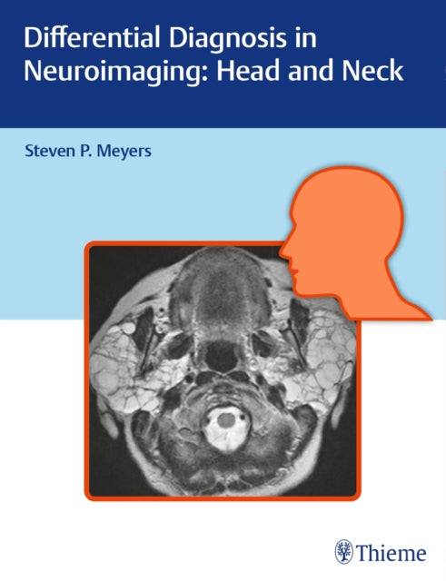 Book cover of: Differential Diagnosis in Neuroimaging: Head and Neck. By: Steven P. Meyers