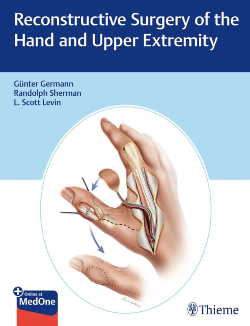 Book cover of: Reconstructive Surgery of the Hand and Upper Extremity. By: Günter Germann