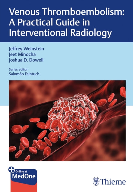 Book cover of: Venous Thromboembolism. By: Jeffrey Weinstein