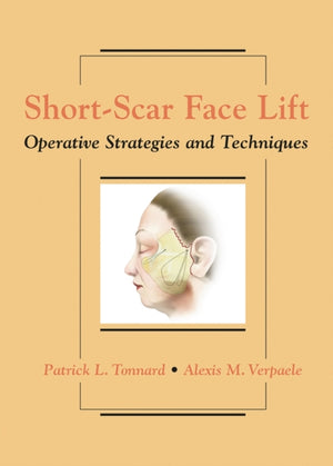Short-Scar Face Lift