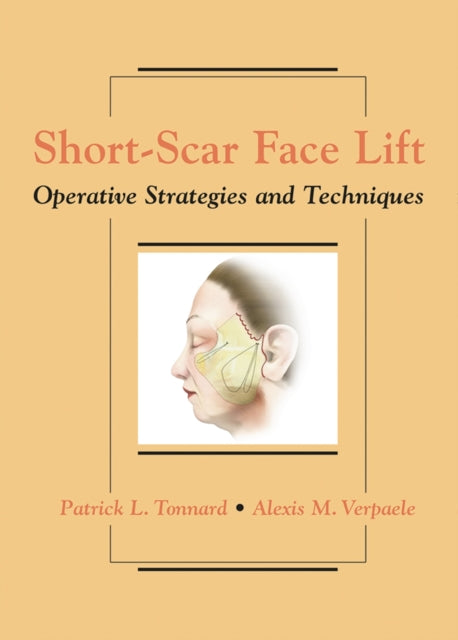 Short-Scar Face Lift
