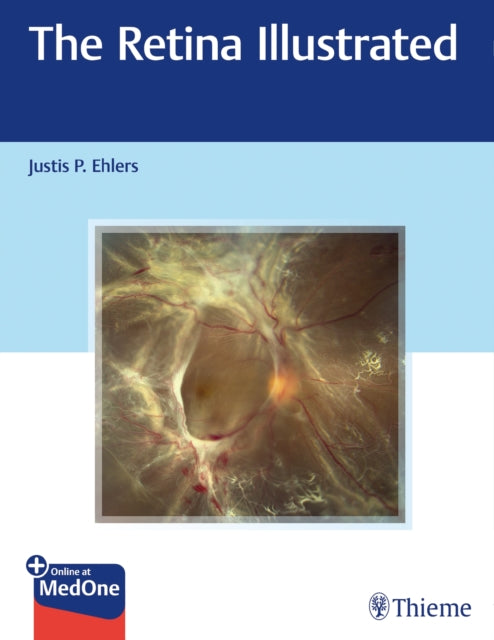 Book cover of: Retina Illustrated. By: Justis Ehlers