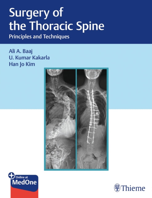Book cover of: Surgery of the Thoracic Spine. By: Ali Baaj