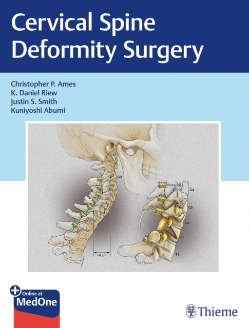 Book cover of: Cervical Spine Deformity Surgery. By: Christopher P. Ames