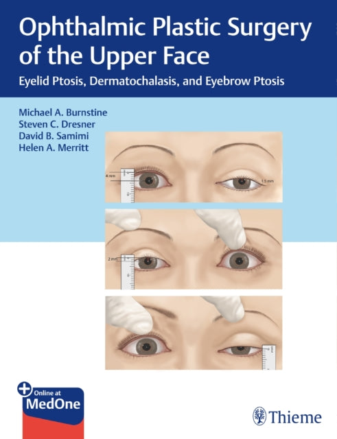 Book cover of: Ophthalmic Plastic Surgery of the Upper Face. By: Michael Burnstine