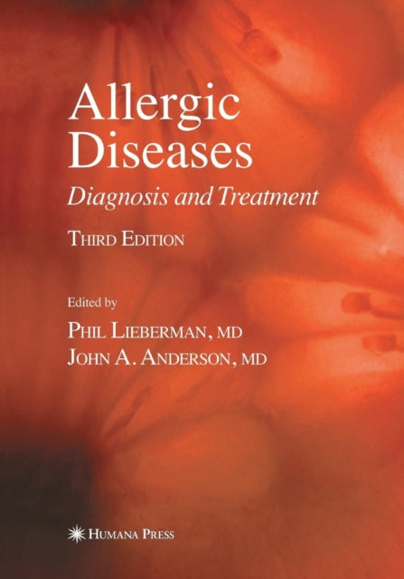 Book cover of: Allergic Diseases. By: Phil Lieberman
