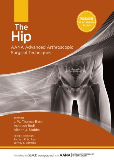 Book cover of: Hip. By: J. W. Thomas Byrd