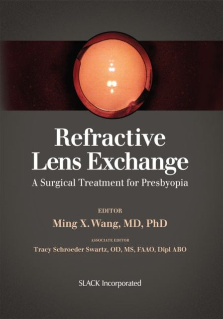 Book cover of: Refractive Lens Exchange. By: Ming X. Wang