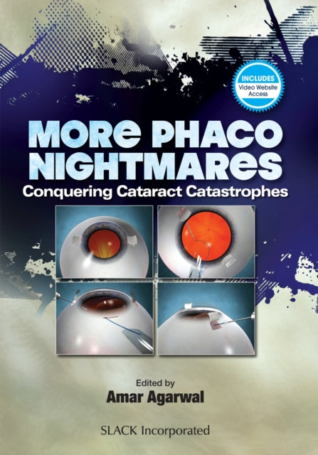 Book cover of: More Phaco Nightmares. By: Amar Agarwal