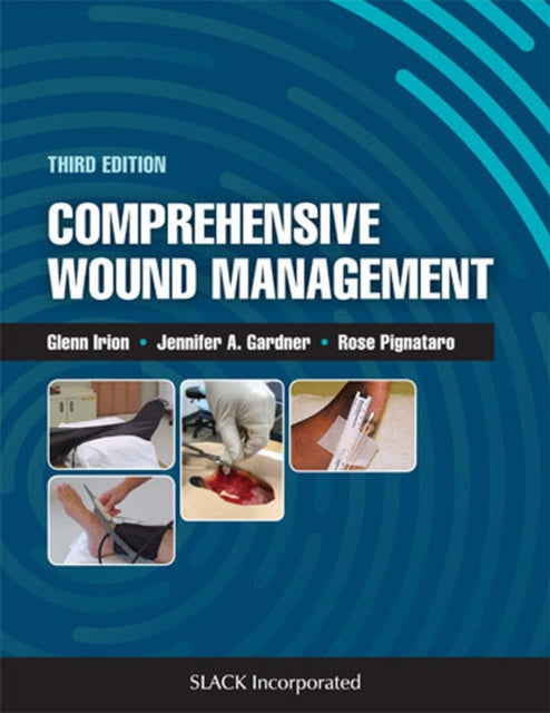 Book cover of: Comprehensive Wound Management. By: Glenn Irion