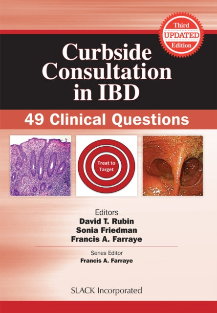 Book cover of: Curbside Consultation in IBD. By: David T. Rubin