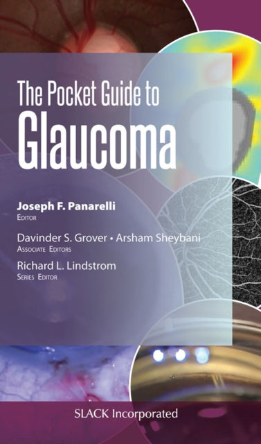 Book cover of: Pocket Guide to Glaucoma. By: J. Panarelli