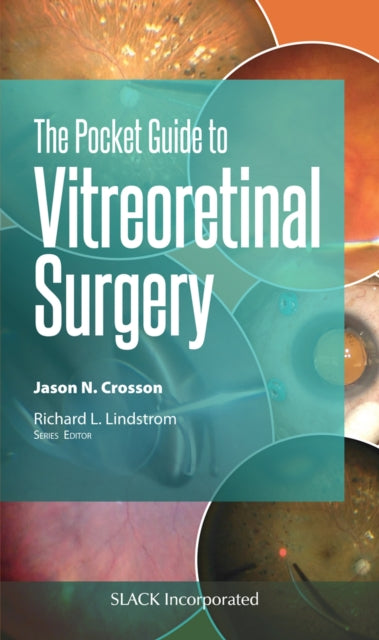 Book cover of: Pocket Guide to Vitreoretinal Surgery. By: Jason Crosson