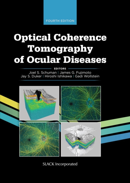 Book cover of: Optical Coherence Tomography of Ocular Diseases. By: Joel S. Schuman