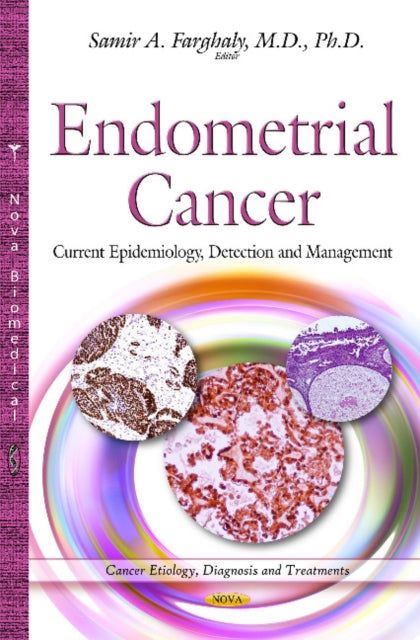 Book cover of: Endometrial Cancer. By: Samir A. Farghaly