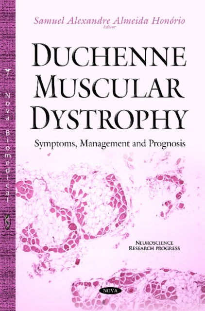Book cover of: Duchenne Muscular Dystrophy. By: Samuel Alexandre Almeida Honorio
