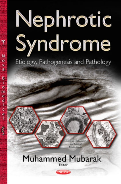 Book cover of: Nephrotic Syndrome. By: Muhammed Mubarak