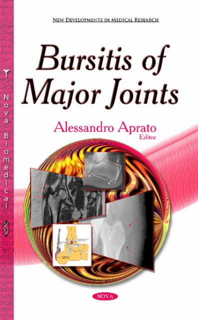 Book cover of: Bursitis of Major Joints. By: Alessandro Aprato