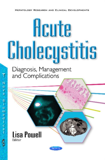 Book cover of: Acute Cholecystitis. By: Lisa Powell