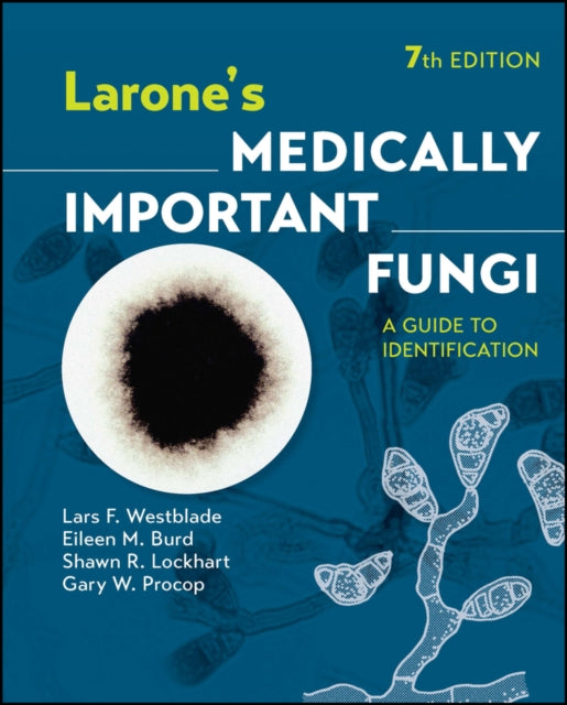Book cover of: Larone's Medically Important Fungi. By: Lars F. Westblade